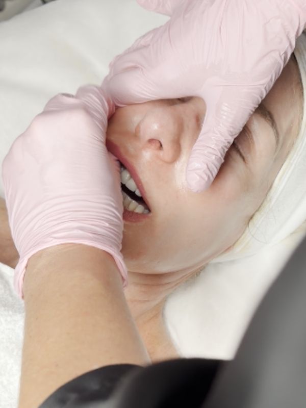 Masaje Intraoral esculpido facial Marbella